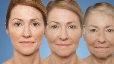 衰老 女人开始衰老，头部会发生4个变化，若你一个没有，说明还算年轻