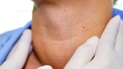 有甲状腺结节，超市3果“倒贴钱”也别买，或能避免结节滋长