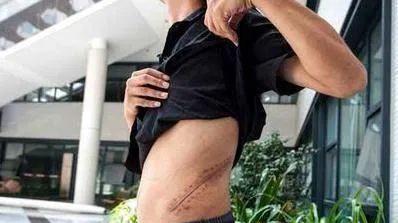 iphone4|十年前，那个 “卖肾买iphone4” 的17岁小伙，现在还活着吗？