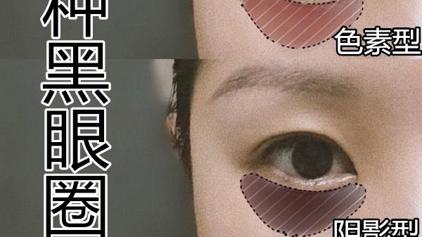 眼妆 你是哪种黑眼圈？黑眼圈类型解析，简单几步淡化你的黑眼圈 。