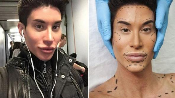 整容|整容最疯狂的六个男人，看到最后一个，网友：无法理解