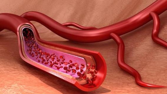 水果|不想被糖尿病并发症“带走”，三招有效预防病症来袭