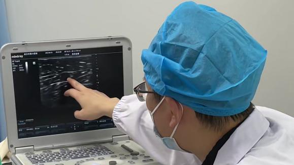 静脉曲张|蚯蚓腿做微创手术当天做完当天走？是真的！