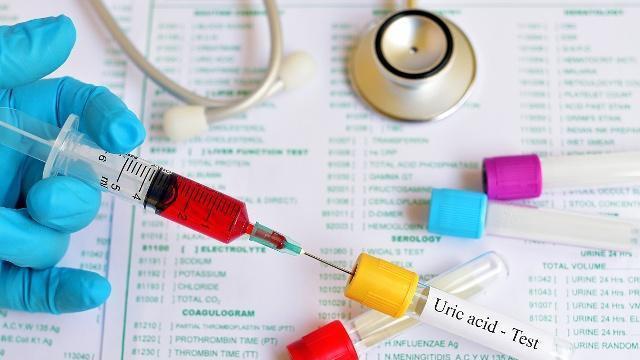 尿酸|这些“排酸高手”就藏在厨房，经常吃点，尿酸不升高，痛风不靠近