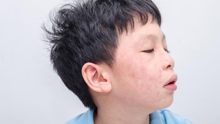 肿瘤|原来晒太阳并不补钙？提醒：真正补钙的方法，还得从这4点做起