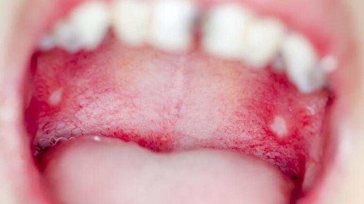 运动|中医常说的阴虚、阳虚和阴阳两虚到底有什么区别？教你5招辨别！