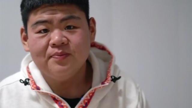 运动 666斤男孩为减肥胃切剩三分之一！一年狂减456斤，现在变得认不出