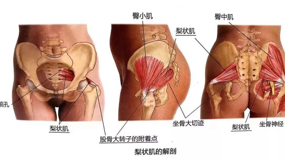 肝脏|臀部酸麻胀痛？你的梨状肌可能损伤了！这几个动作帮你摆脱苦恼！