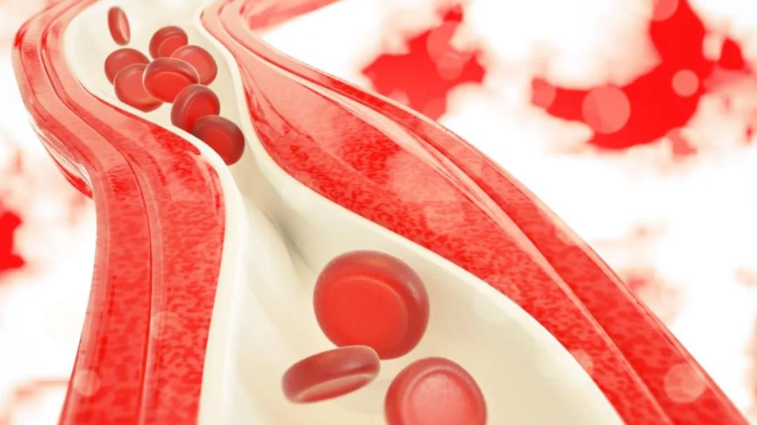 脂肪酸|动脉硬化是“男人最坏的敌人”！牢记5步养护法，疏通血管少堵塞