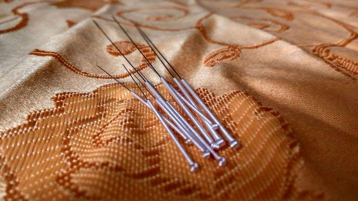 针灸|一根银针“征服”了很多人，中医董景昌创造性发展了中医针灸