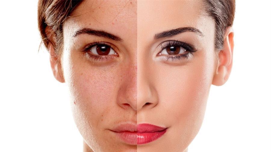 维生素E|巧用维生素E，助你告别斑斑点点，年轻5岁或不是梦