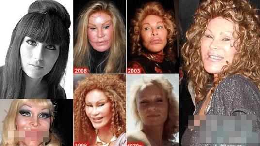 整容|4位“瞎整容”的女星，前3位很惋惜，最后一位花千万整成怪物