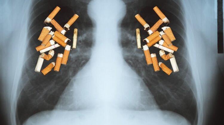 肺癌|100个烟民中，会有多少人死于肺癌？提醒：出现3个异常，该戒烟了