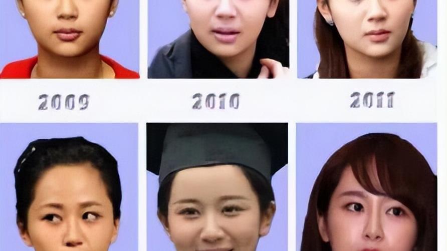 杨紫|杨紫下巴有个坑还会回弹 粉丝说这是正常现象网友这是整容后遗症