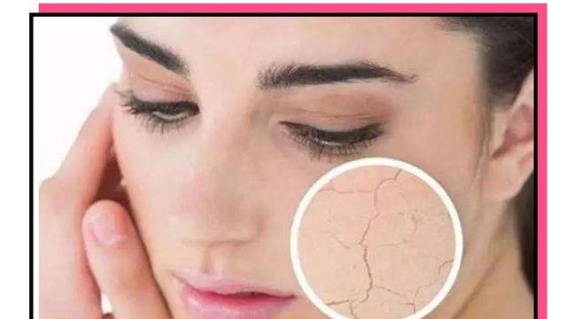 护肤品|用这么多护肤品，皮肤还是会出现痘痘暗黄斑点等问题，原因在这里