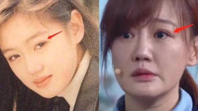 薛佳凝|44岁薛佳凝被指变化大：皮肤松弛老态明显，脸也愈发“绷不住”了