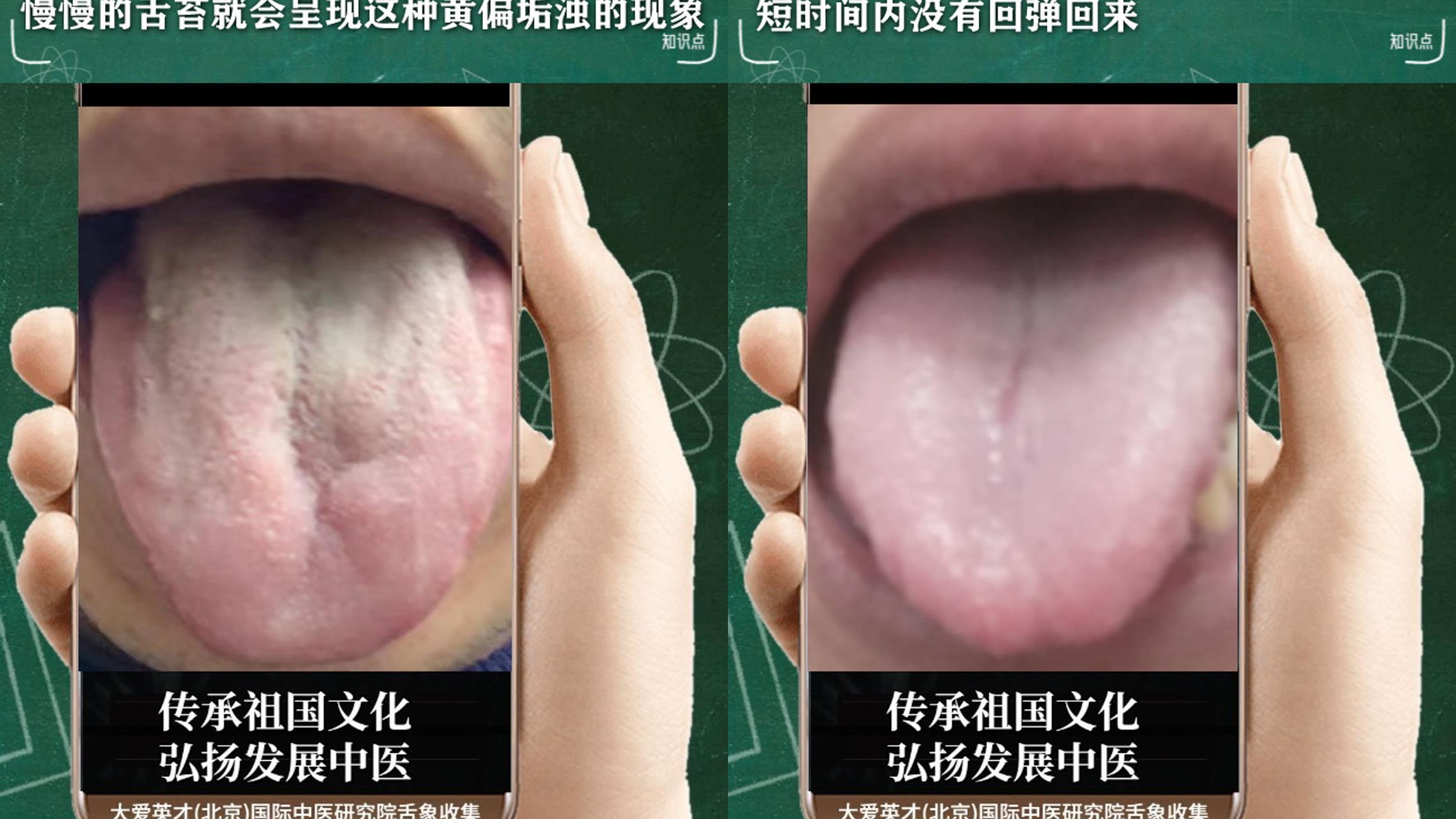 皮肤病|中医解析：工作效率低下，经常咳嗽，口苦，脾虚肾弱