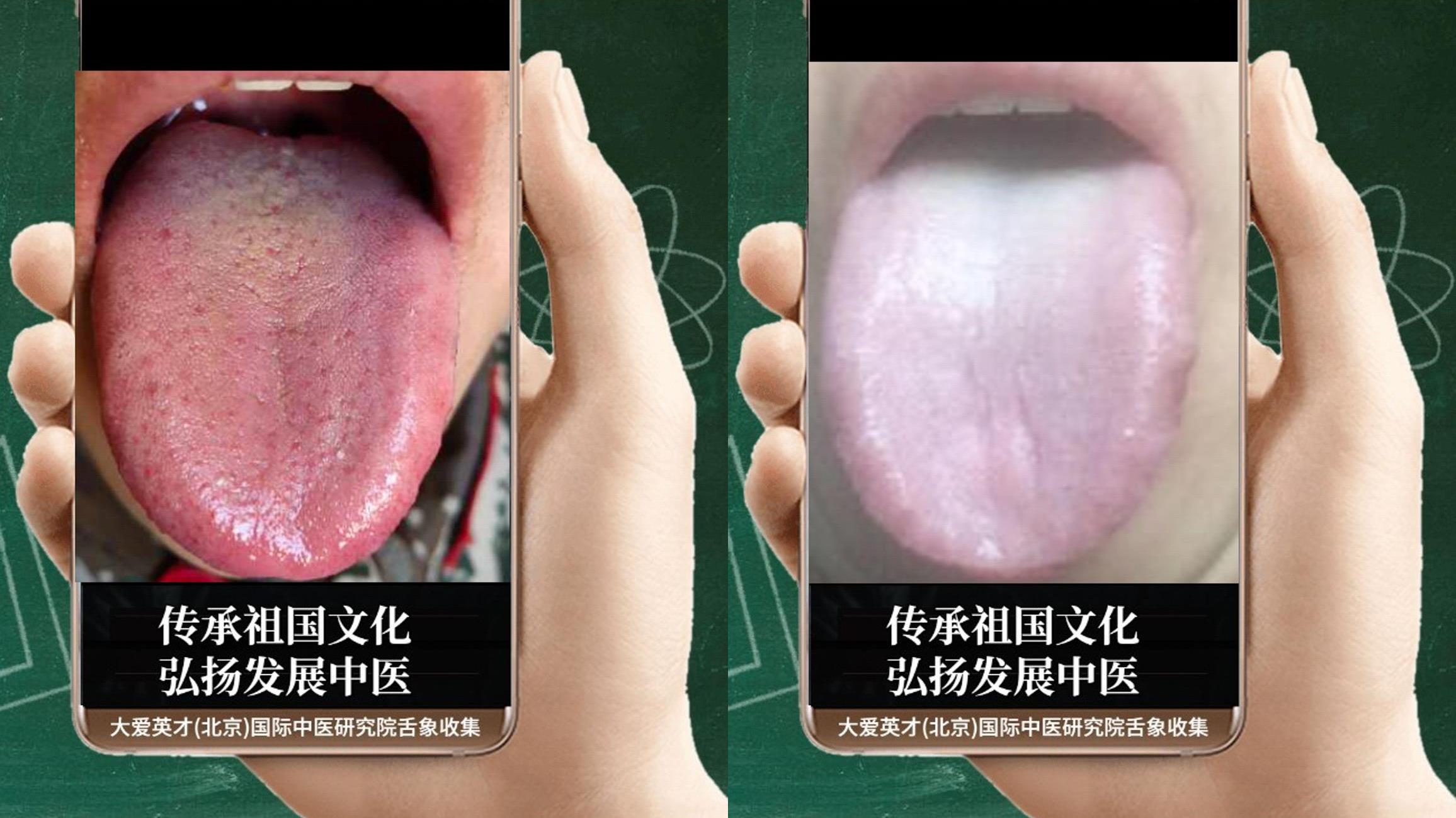 脾胃|中医实例：口干口苦，关节酸痛、痰多色白，脾胃失常