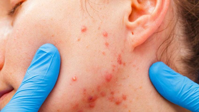 腹泻|想让皮肤变得更好，不妨多吃这5种食物，或能促进皮肤健康