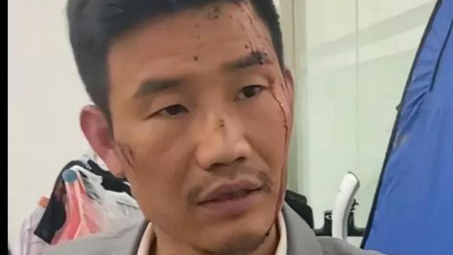 古天乐|嘎子自曝：在缅甸拍扫毒电影，片酬1.8个亿，比古天乐还要高两倍