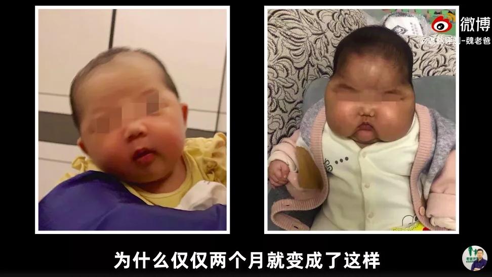 护肤品 宝宝护肤品成分越少越安全吗？育婴师教你看懂极简配方！