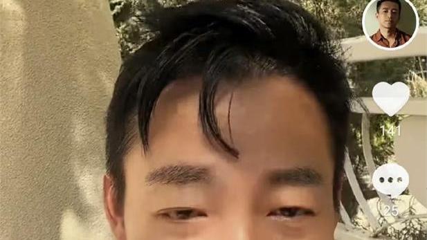 汪小菲|汪小菲被打入院？神隐4天脸色憔悴眼睛肿胀！直播澄清