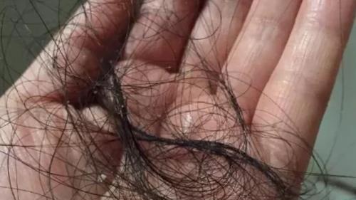 土豆 脱发真正“凶手”终于找到了，央视曝光的这几种洗发水，你还敢用吗？