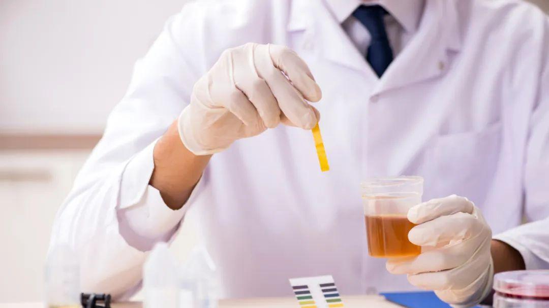 尿常规|尿常规报告透露的4个信号，这项不达标的多半肾不好