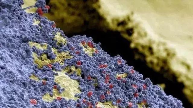 牙齿|掉牙和患癌风险有关？六十岁的人，牙齿剩多少颗才正常？标准来了