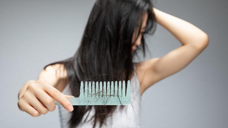 |假发制品需求旺盛，“秃”如其来的“脱发危机”加速假发行业发展