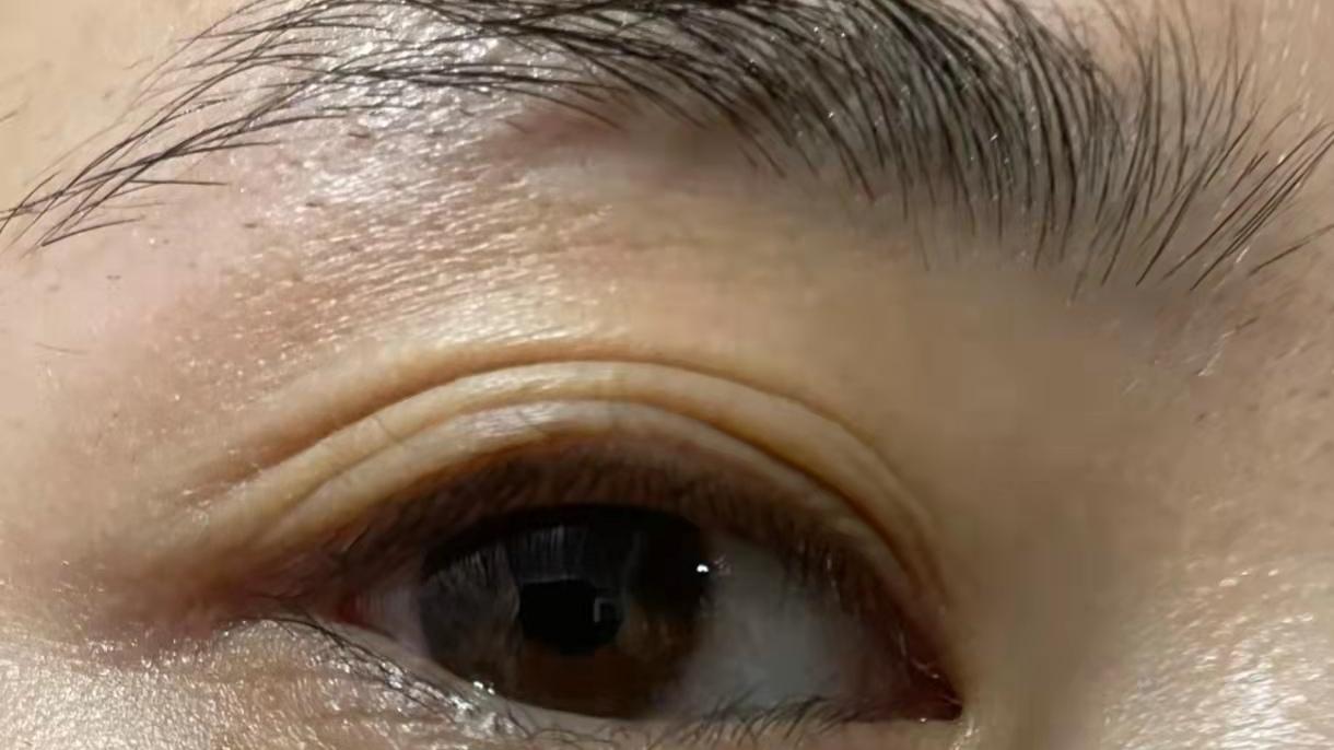 眼霜 长期使用眼霜VS长期不用眼霜，十年后皮肤有何不同？差距一目了然，你呢