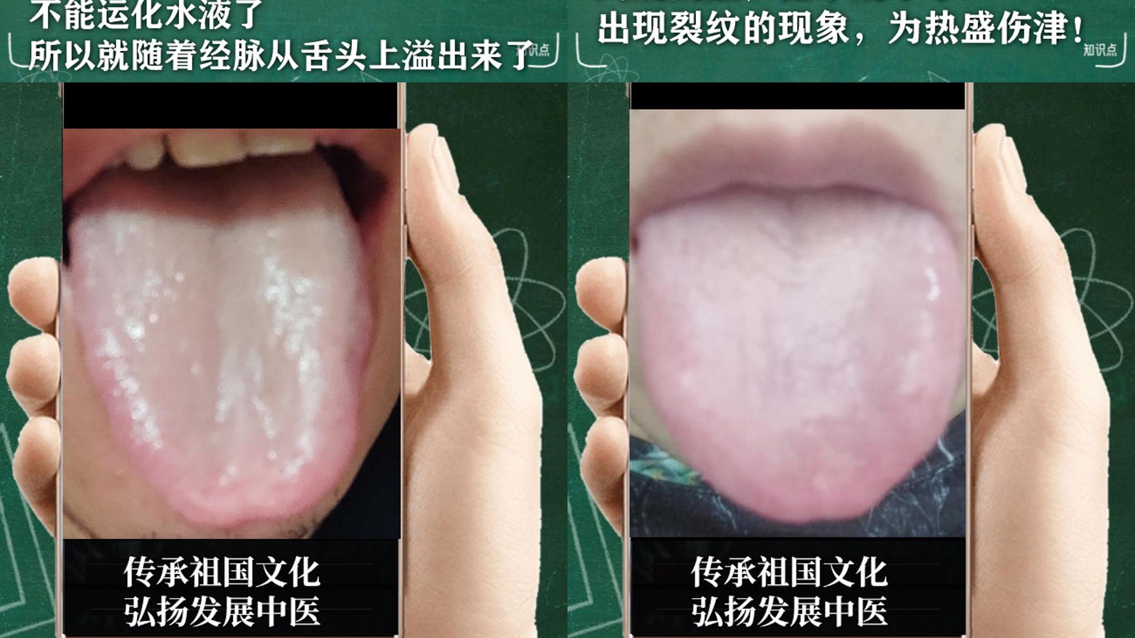 处方|中医解析：总是内心不安，心烦意乱，湿热下注，阴阳亏虚