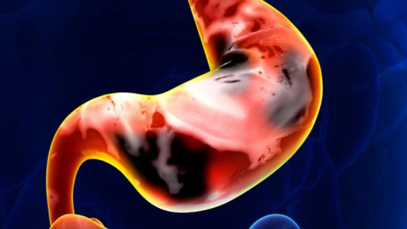 牛奶|胃的“保护伞”已公布，不是南瓜牛奶，医生：你若爱吃，胃会感谢你