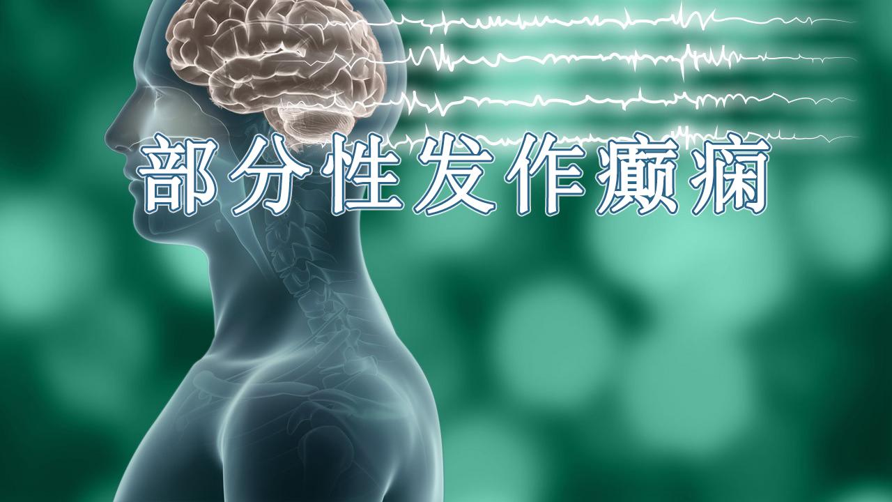 美国食品药品监督管理局|部分性发作癫痫新药！ZONISADE(唑尼沙胺口服混悬剂)获FDA批准