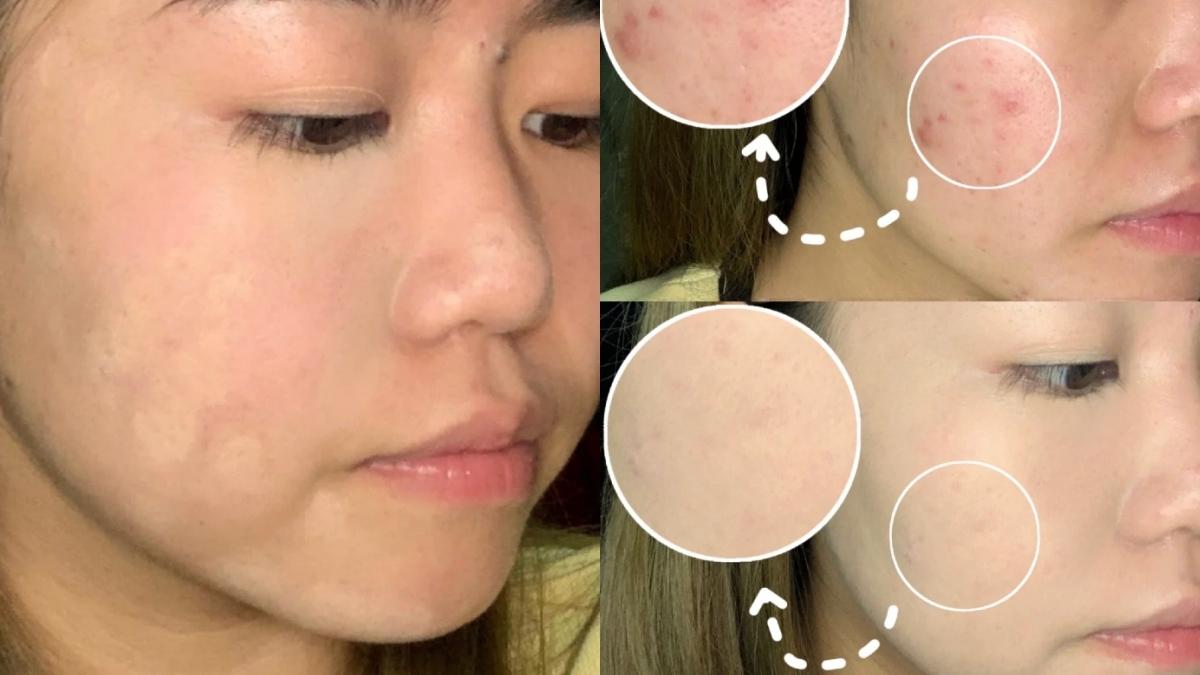 穿衣搭配 脸上有痘不能这样遮！化妆师常用的「遮瑕方法」，泪沟、黑眼圈这样遮才干净