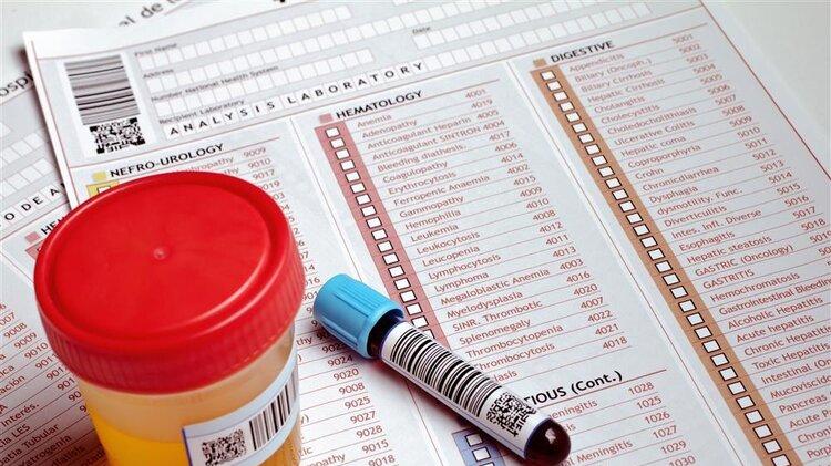 疾病|尿是人体晴雨表？提醒：尿液出现8种颜色异常，是身体在告密