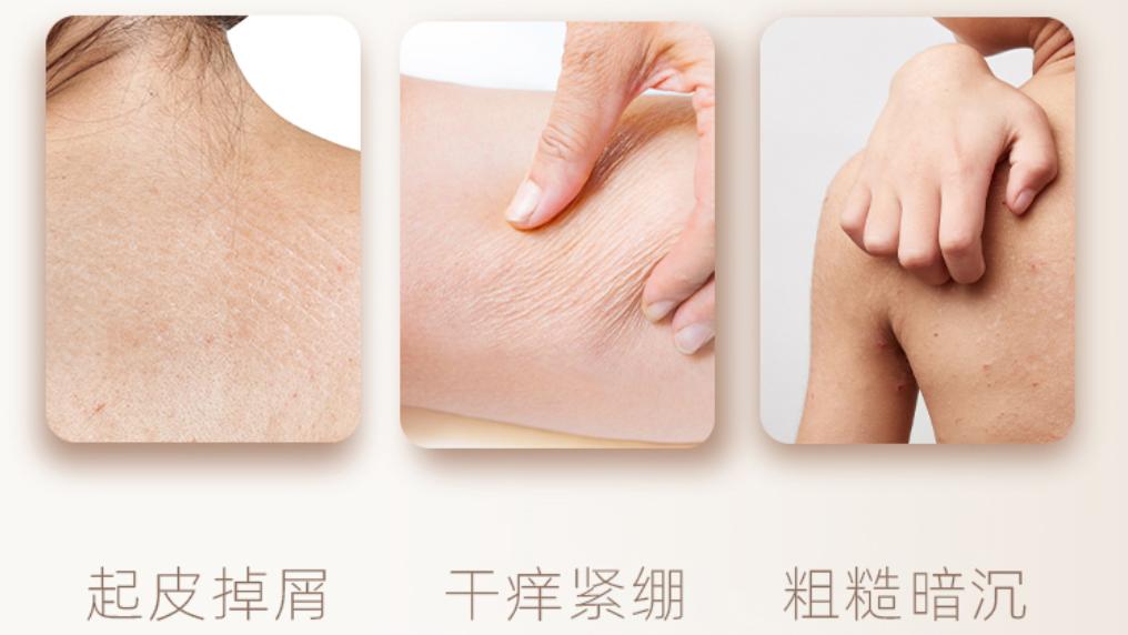 运动 一年之肌在于春，春季护肤3大绝招