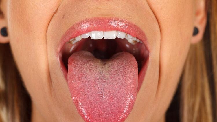 医院|提醒：舌头出现这5个变化，暗示你生“大病”了！赶紧治疗