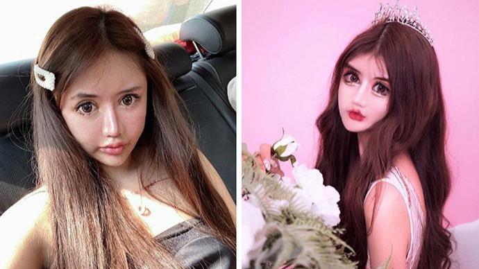 整容|网红13岁起整容100次！炫耀去赖冠霖公司面试，网友：你的才艺就是脸吓人