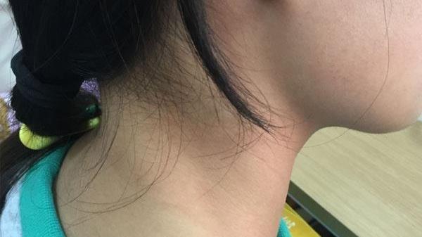 |为什么有的人平时很健康，却突然得了癌症？看完后你就会懂了！