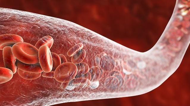 穴位|“血稠”最怕这8种好习惯，坚持一年以上，血管畅通无阻