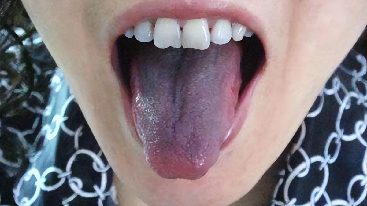 陈皮|世间本无病，只是痰和瘀！3味药，一味活血、一味化痰、一味养阴