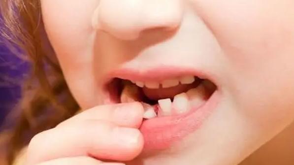 银耳|人到中年，牙龈萎缩，烦恼加倍，每天注意3点预防，远离拔牙不是梦