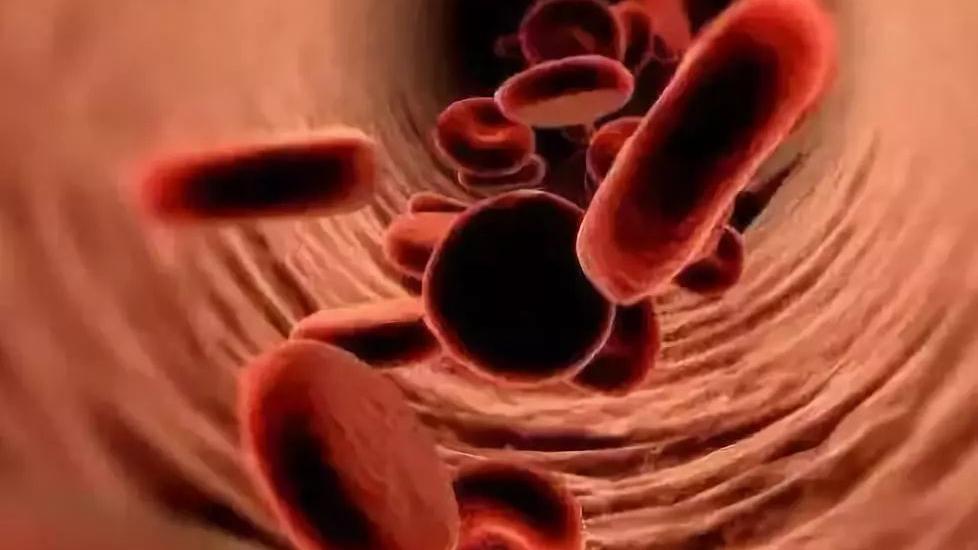 降血脂|如何长期有效的降血压降血脂？