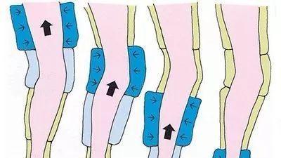 静脉曲张|静脉曲张不可怕！“直击灵魂”三大问：找对人、管住嘴、迈开腿？