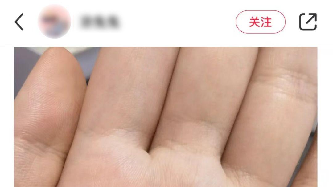 |网友在老公身上发现不明物体，在线求助后，得到的答案五花八门