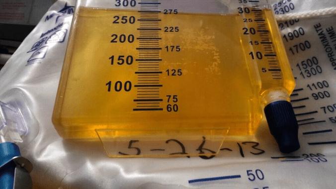 中成药|肌酐升高后想要避免尿毒症？把这一件事做好，肾病起码好一半