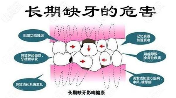 立秋|长期缺少一颗牙会带来什么影响？