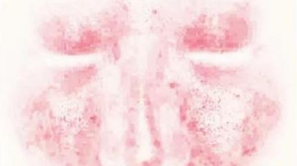 云朵 敏感肌如何彻底修复好