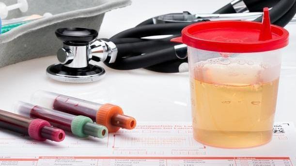 肾病|肾脏出现硬化，肾功能已无药可救？相比硬化，肾脏更怕这件事